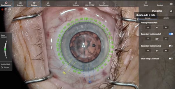 Keep Your Eyes on the “Road” With NGENUITY thumbnail