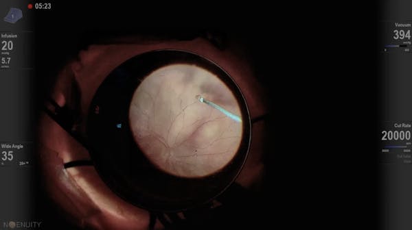 Tissue Detail Mode in NGENUITY 1.5 thumbnail