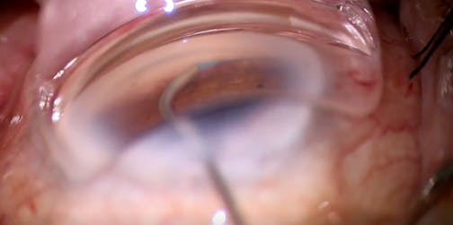 Using Multiple Technologies