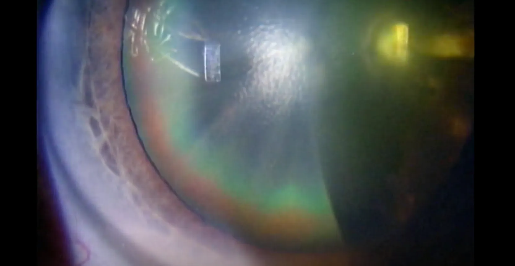 Vineet Ratra The Quest - Eyetube