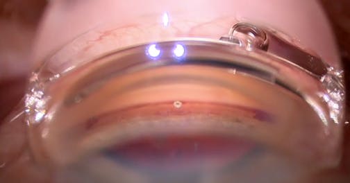 Addressing Drop Adherence