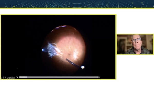 The Role of Imaging in Assessing Vitreous Opacities thumbnail