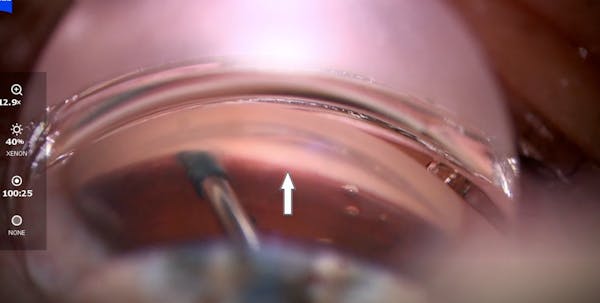 Strreamline Viscoelastic Canal Fluid Wave thumbnail