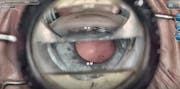 Ahmed DVX Prism for ORA and Hydrus Cases