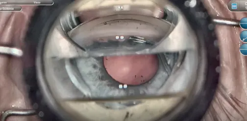 Ahmed DVX Prism for ORA and Hydrus Cases
