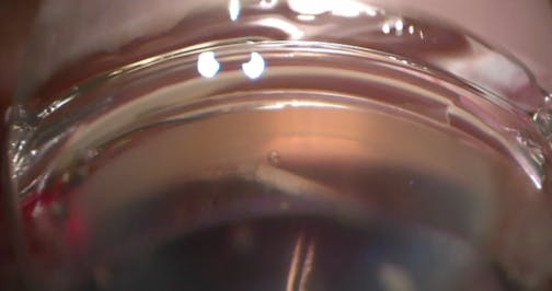 iTrack Canaloplasty With 90° Goniotomy