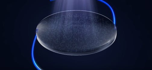 Light Adjustable Lens
