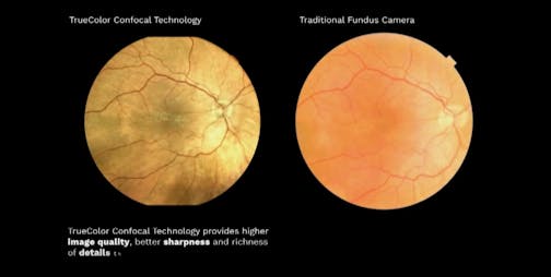 EIDON TrueColor Confocal Scanning