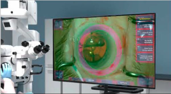 Cassini Technologies - Digitalizing the Cataract Surgery Experience thumbnail