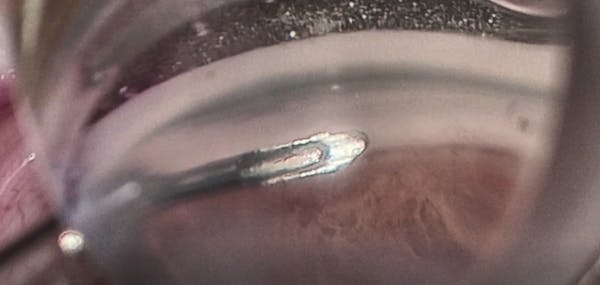 Tips for the Hydrus Tip thumbnail