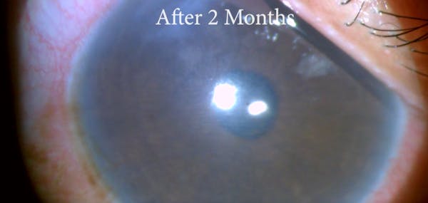 Polypharmacy Psychosis thumbnail