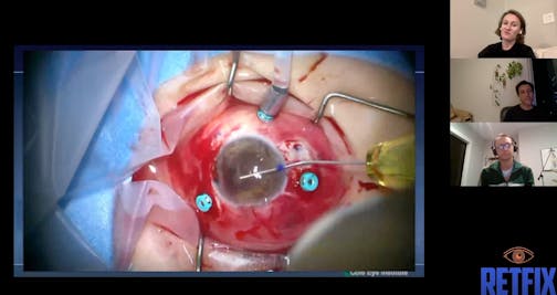 Episode 13 Part 2: Secondary IOL Pearls