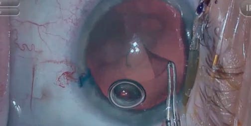 The Personality of the Capsule
