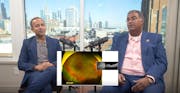 Episode 14 Part 1: Scleral Buckles
