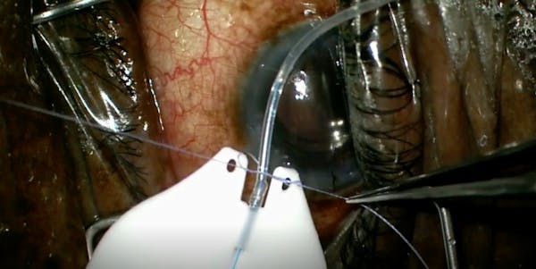 Salvaged Cut Tube thumbnail