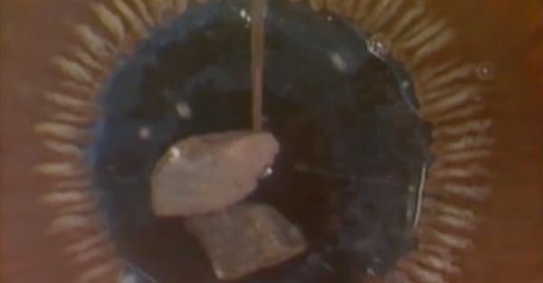The Mature Cataract and Its Sharp Edges: Fact or Fiction thumbnail