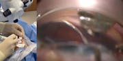VIA360 Surgical System Demonstration