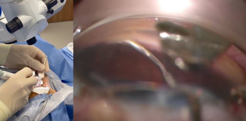 VIA360 Surgical System Demonstration