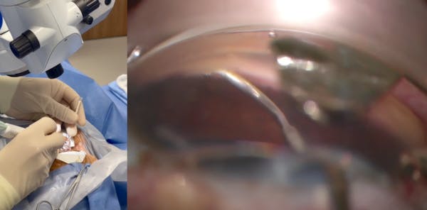 VIA360 Surgical System Demonstration thumbnail