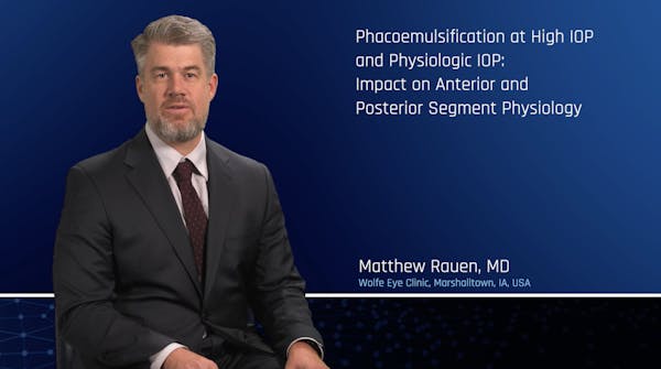 Phacoemulsification at High IOP and Physiologic IOP thumbnail