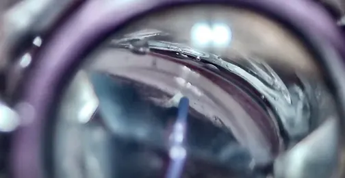 AlloFlo Supraciliary Procedure In Eye With Previous Surgery