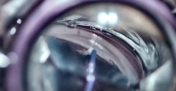 AlloFlo Supraciliary Procedure In Eye With Previous Surgery thumbnail