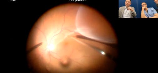 Episode 17 Part 2: Tips and Tricks During Complex Surgery