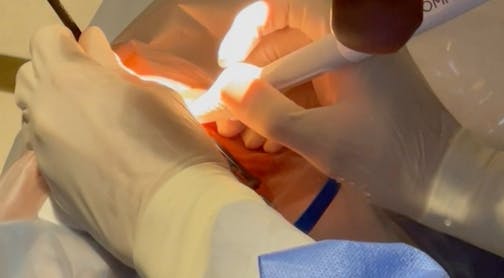 Pearls for Stent Implantation: Microscope and Patient Positioning