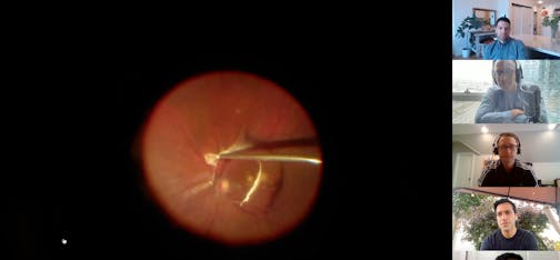 Episode 18 Part 1: Vitreoretinal Surgery in Uveitis