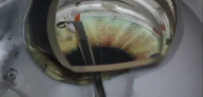 KDB Glide Surgical Techniques thumbnail