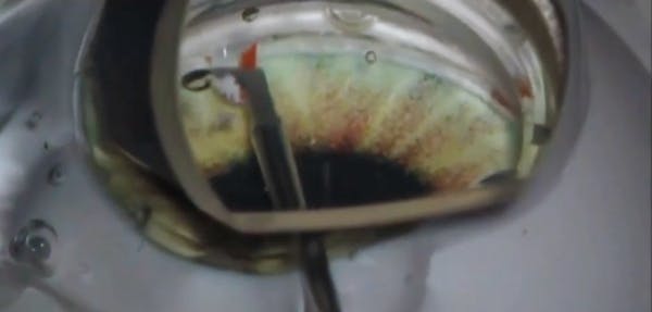 KDB Glide Surgical Techniques thumbnail