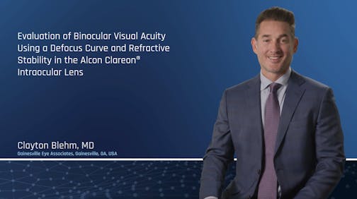Evaluation of Binocular Visual Acuity, Defocus Curve and Refractive Stability with Clareon Monofocal IOL