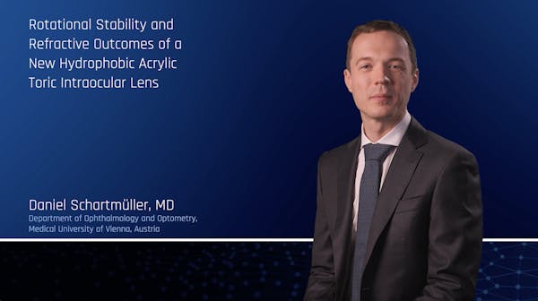 Rotational Stability And Refractive Outcomes Of A New Hydrophobic Acrylic Toric Intraocular Lens thumbnail