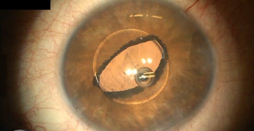 Megalophthalmos