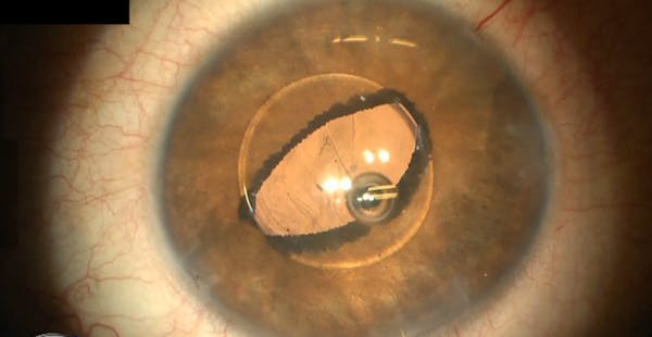 Megalophthalmos thumbnail