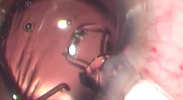 Injector Surprise thumbnail