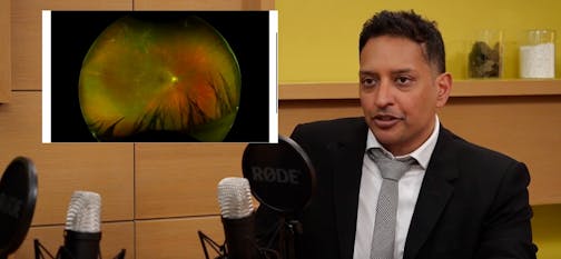 Episode 20 Part 3: Pneumatic Retinopexy Techniques