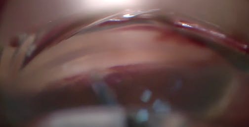 Standalone AlloFlo Uveo Case