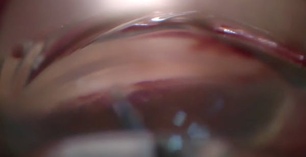 Standalone AlloFlo Uveo Case thumbnail