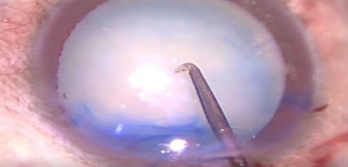 Preventing the Argentinian Flag