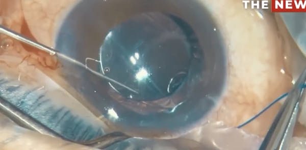 New Angled CTS thumbnail