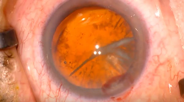 A Career of Instrument Design thumbnail