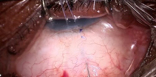 AquaLumen Single Pass