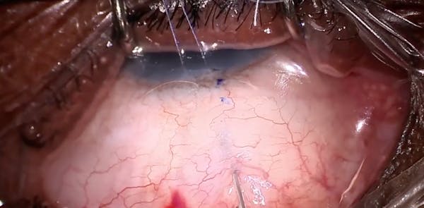 AquaLumen Single Pass thumbnail