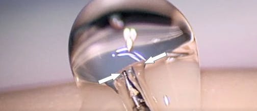 Use of the Streamline Clear Device