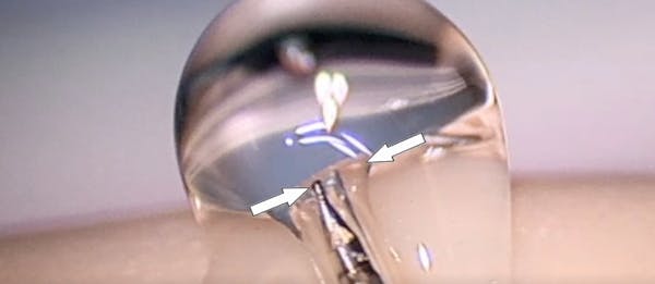 Use of the Streamline Clear Device thumbnail