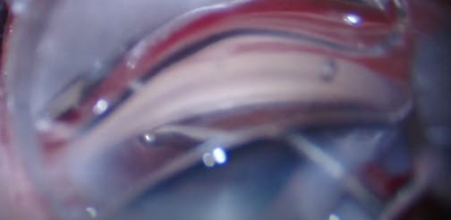 AlloFlo: Lamellar Tissue Planes