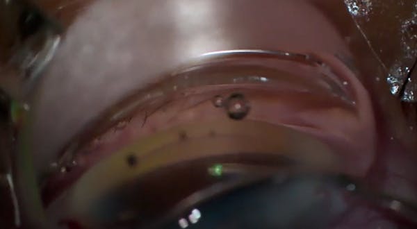 iTrack Green iLumin (Blanching) thumbnail