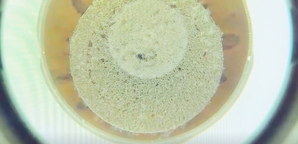 SMILE Pro Cap Slippage During Incision thumbnail