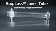 StopLoss<sup>™</sup> Jones tube | CDCR | Step-by-step Procedure